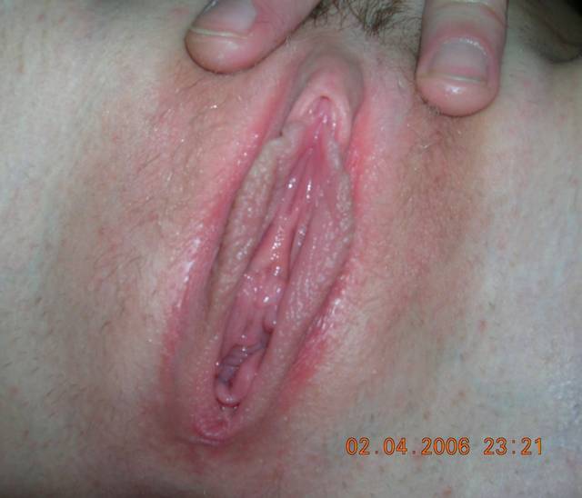 moja cipeczka - szaleni