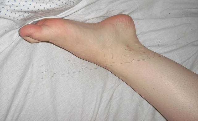 Stópeczka cd. - PARANASEX