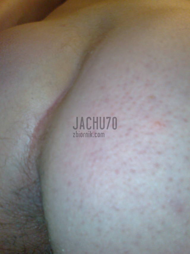 JACHU70