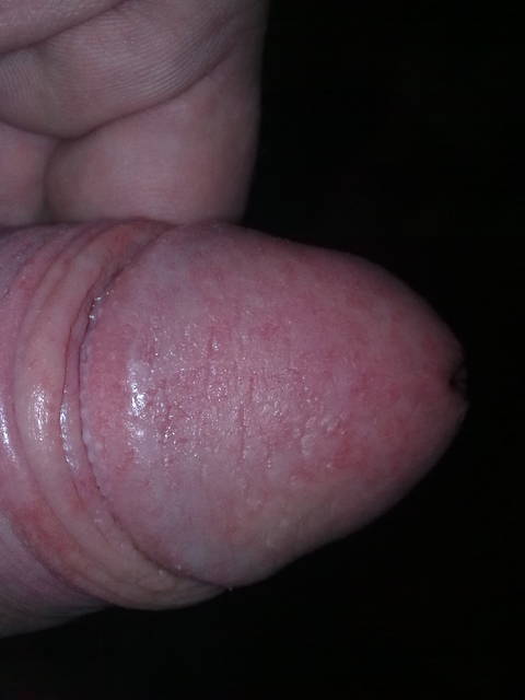 odpoczywa - tomek132