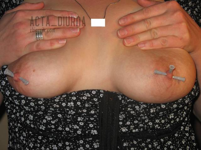 igiełki... - acta_diurna