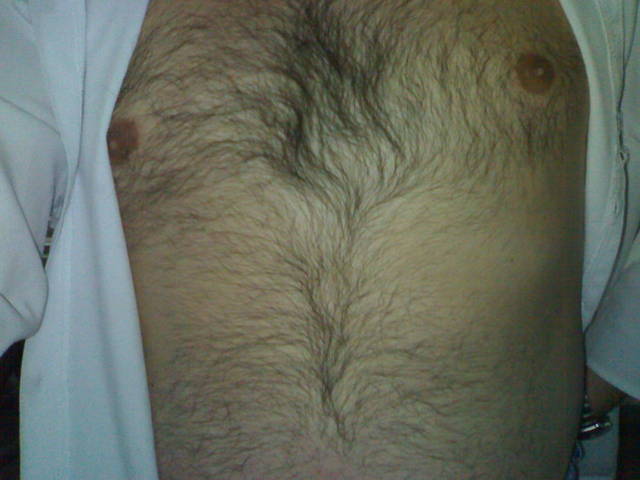 150620093186.jpg - spermikon