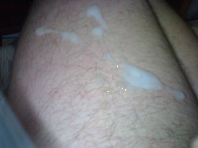 300720093252.jpg - spermikon