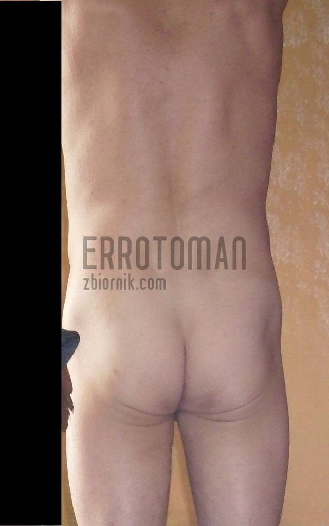 errotoMAN