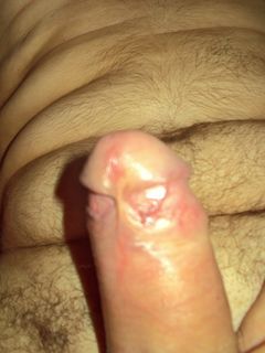 pocałuj króla w berło