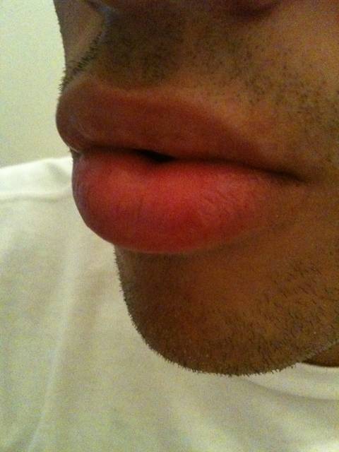 MY LIPS - Vuitton_Don