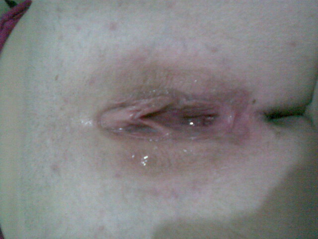 Mokrutka od Spermy - paraCz20