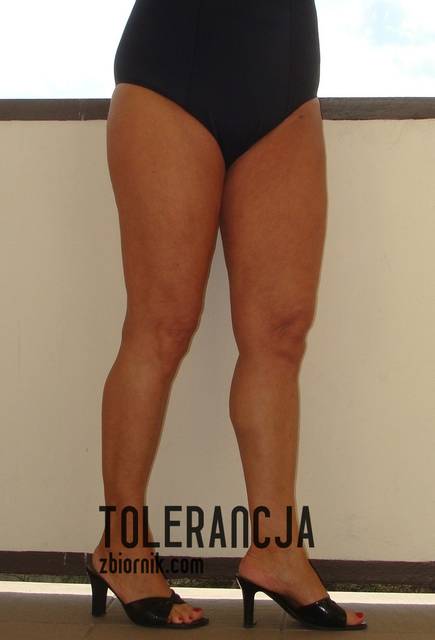 DSC01563.13-09-2010.JPG - Tolerancja