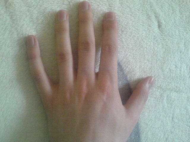 dotykam - normalny1984