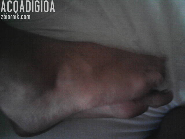 stopki - acqadigioa