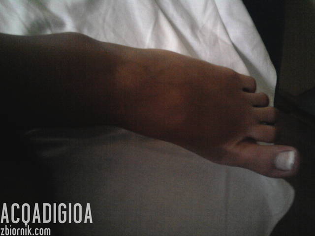acqadigioa