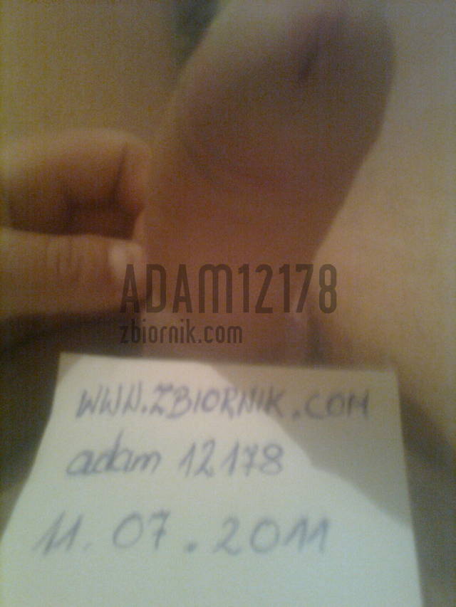 adam12178