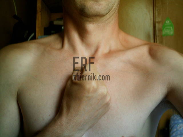 X2 004.jpg - Erf