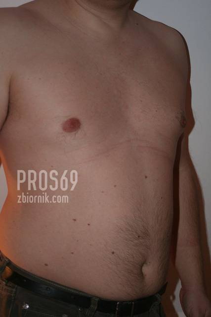 Brzuszysko - pros69