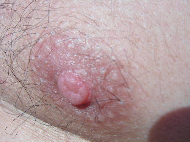 mój sutek..:) - Sedecrem