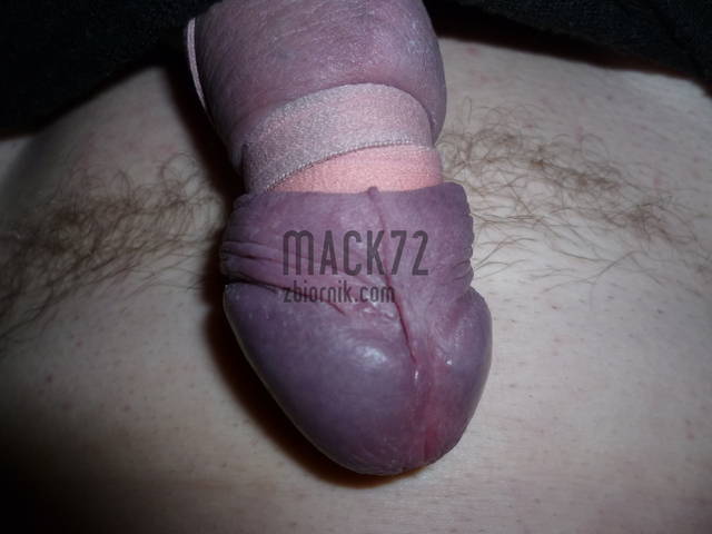 mack72