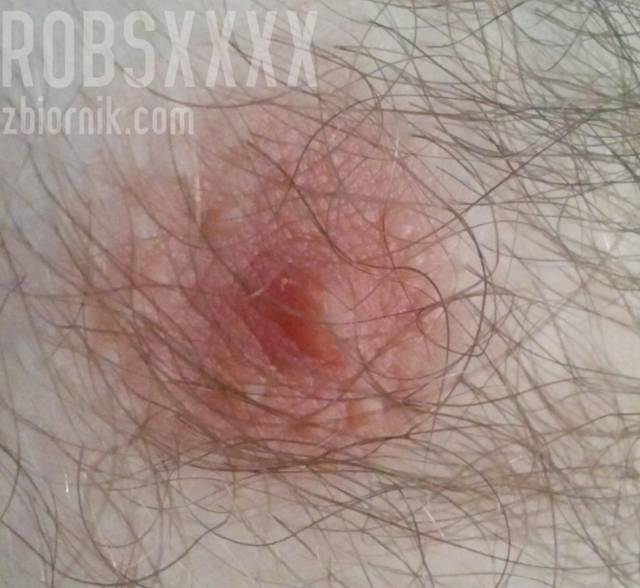 coś innego? - robsxxxx