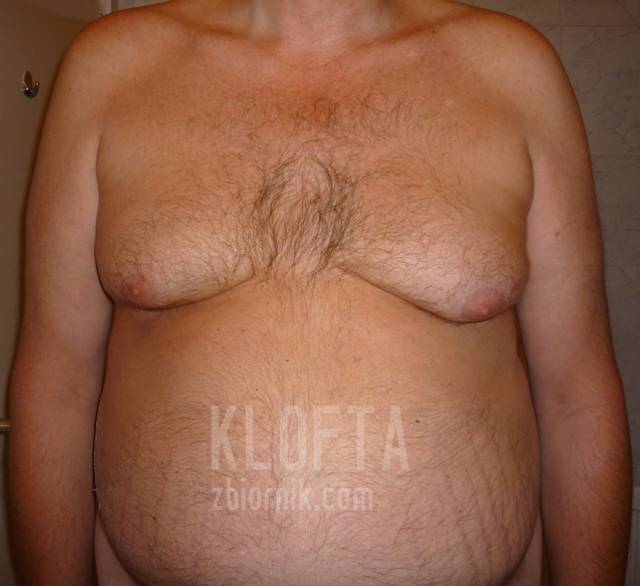 13* - klofta