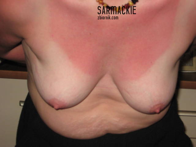 nieopalone I - sarmackie