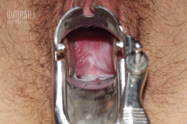 gyno - wmpara