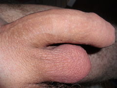 on