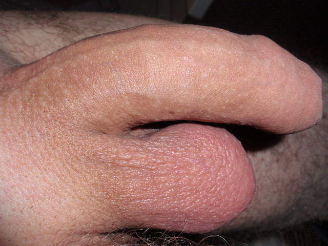 on - RAFAL1978