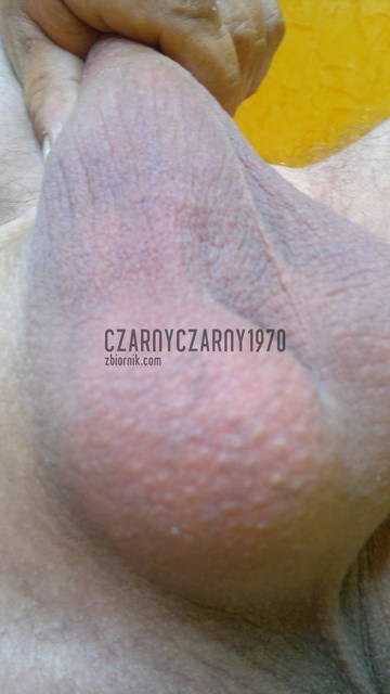 lyse jaja do wylizania - czarnyczarny1970