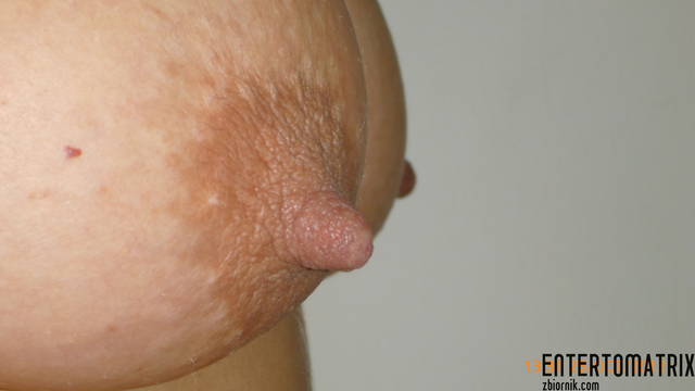 HD 079 - entertomatrix