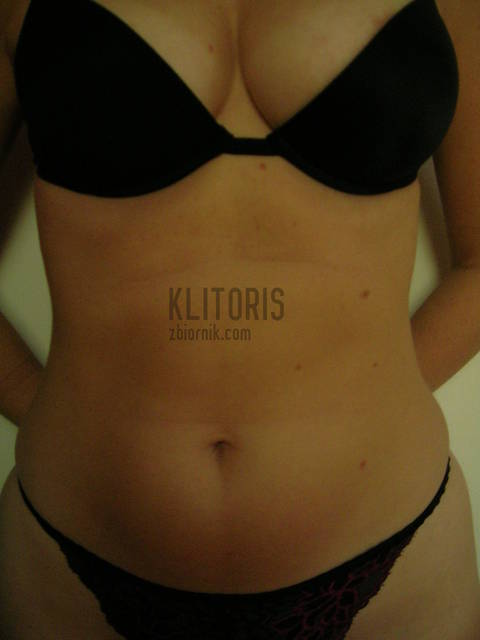 DSCN4426.JPG - klitoris