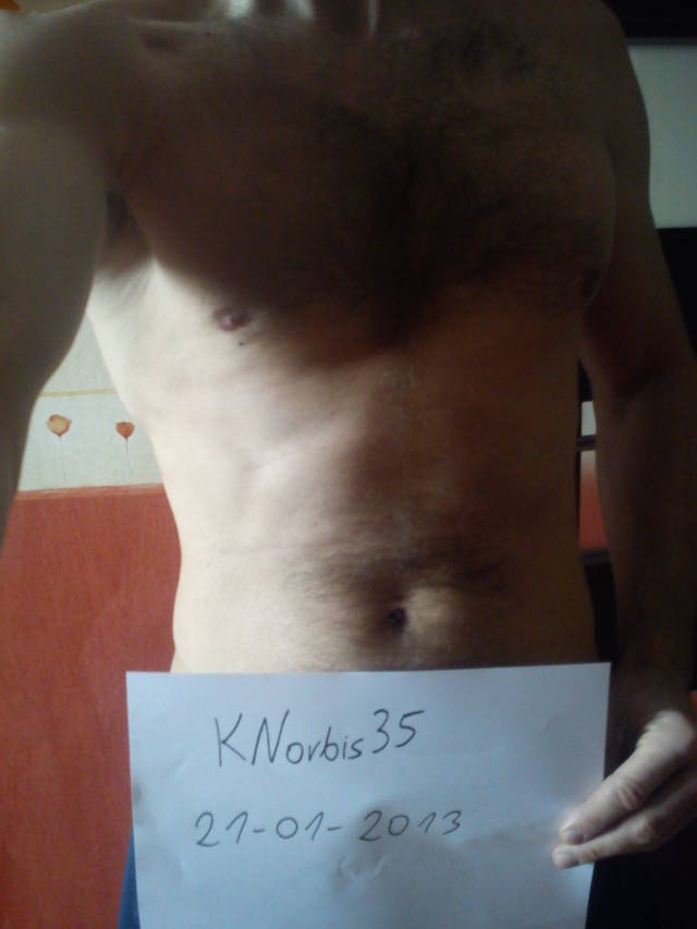 KNorbis35