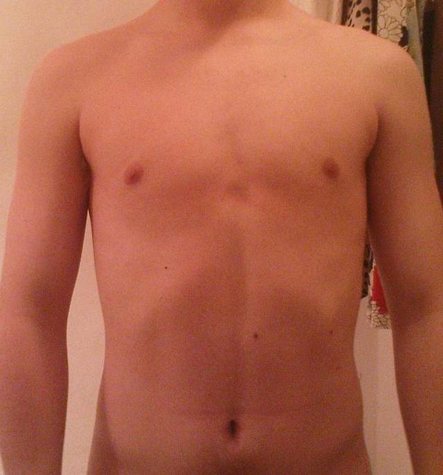 supriseboy89