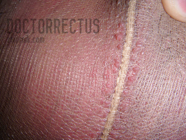 doctorrectus