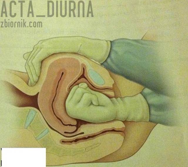 Fisting troszkę z innej strony :)) - acta_diurna