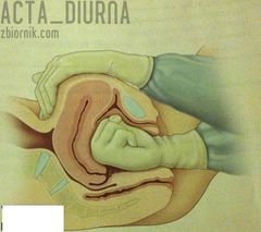 Fisting troszkę z innej strony :))