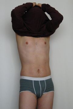 ciacho ;)
