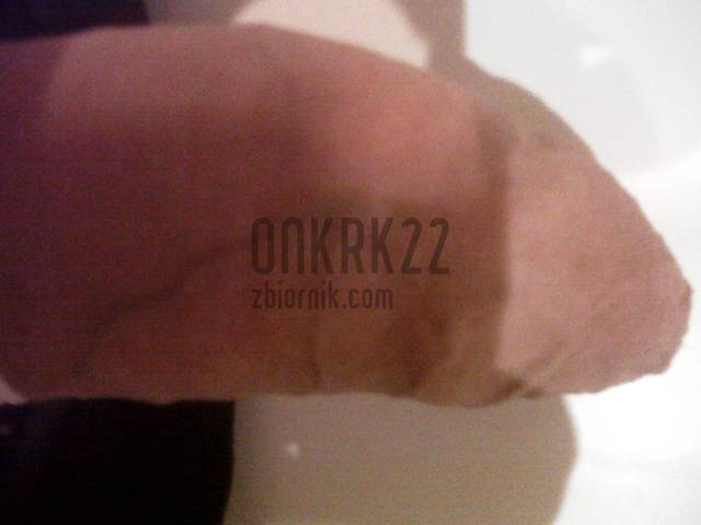 Slaba jakość poprawię sie. - onkrk22