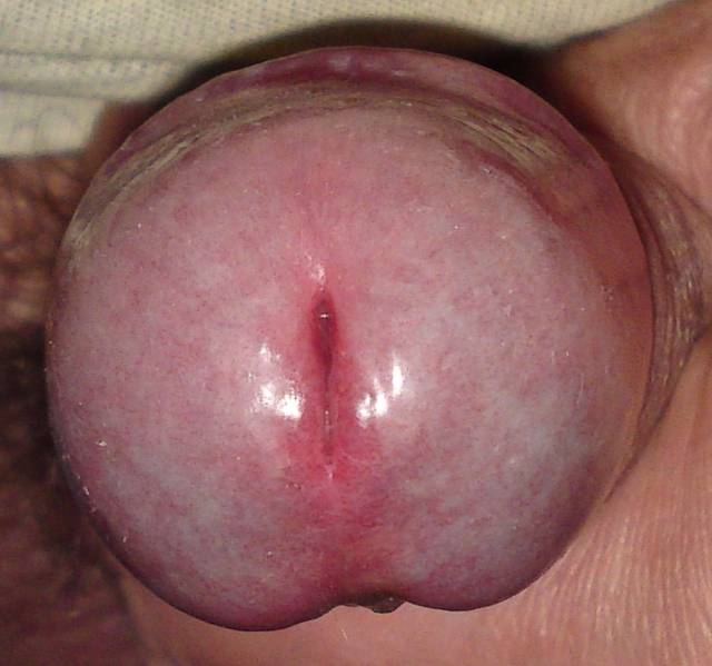 Sama główka... - Jacencior