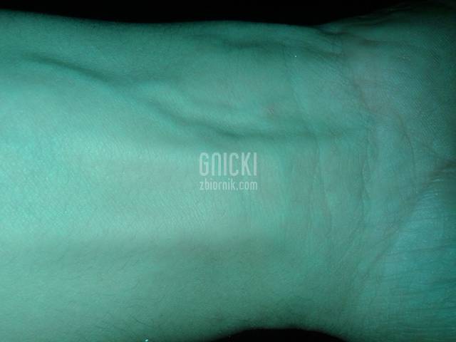 gnicki