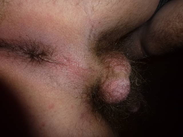 fuxs