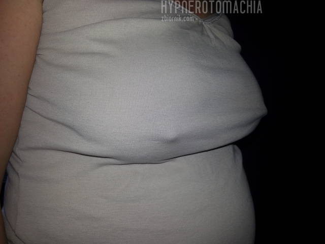 20141227_100239.jpg - hypnerotomachia