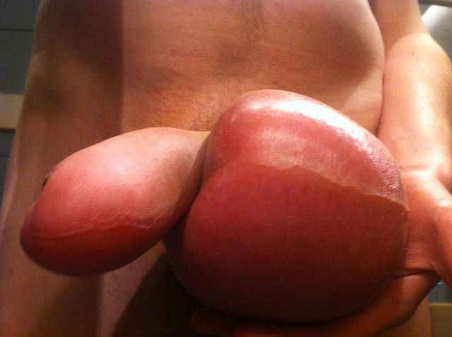 Czy na mosznie mogą pojawić się rozstępy? - RATCVAC