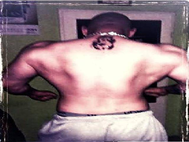 Moje plecy aktualnie, mam mikro kamerke szukam ;) - czystehc