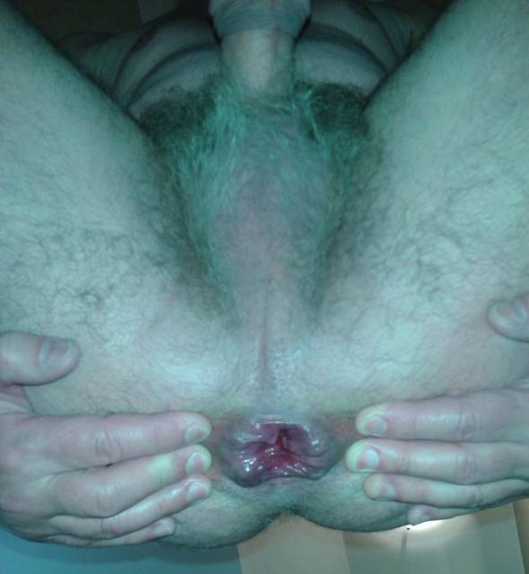 Anal 3.jpg - Marekbins