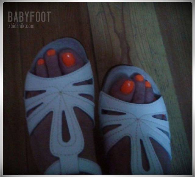 10 fotka - Babyfoot