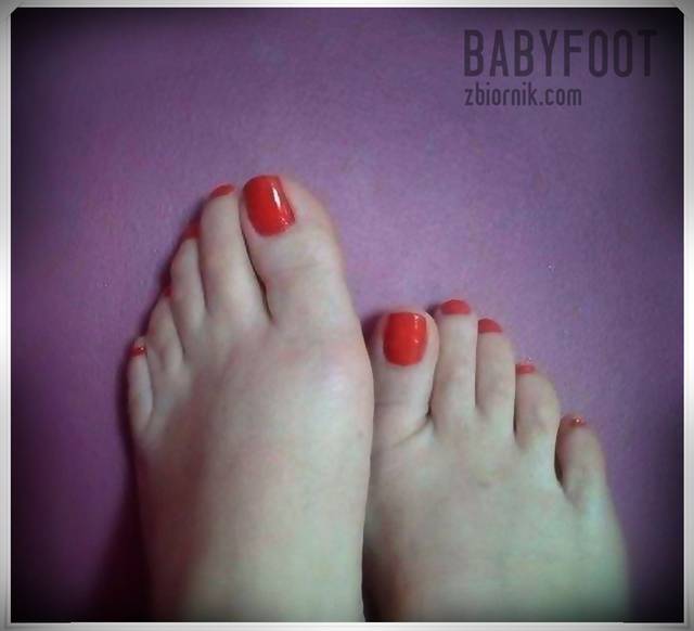 czerwone lizaczki - Babyfoot