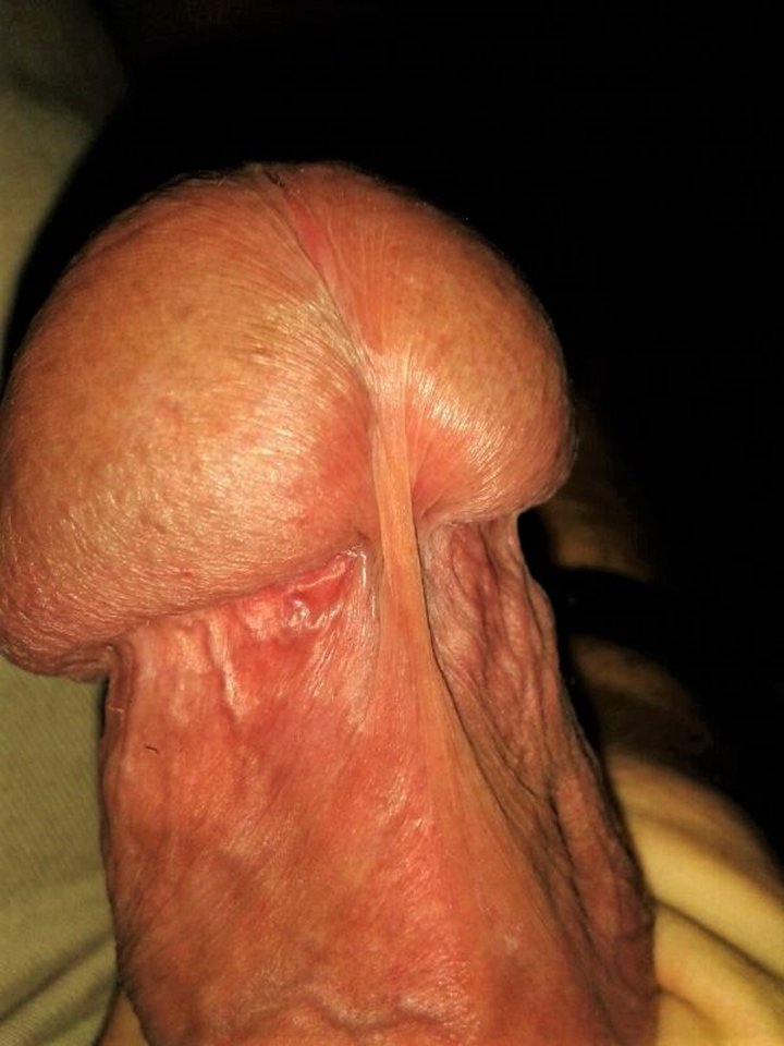 atomowy...grzybek - parkampj