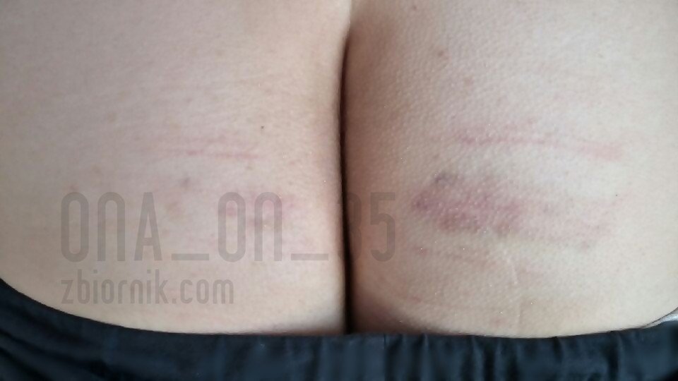 Bolałooo...  - Ona_On_35