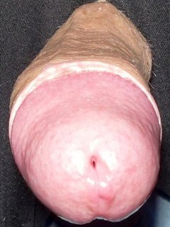 Oko cyklopu