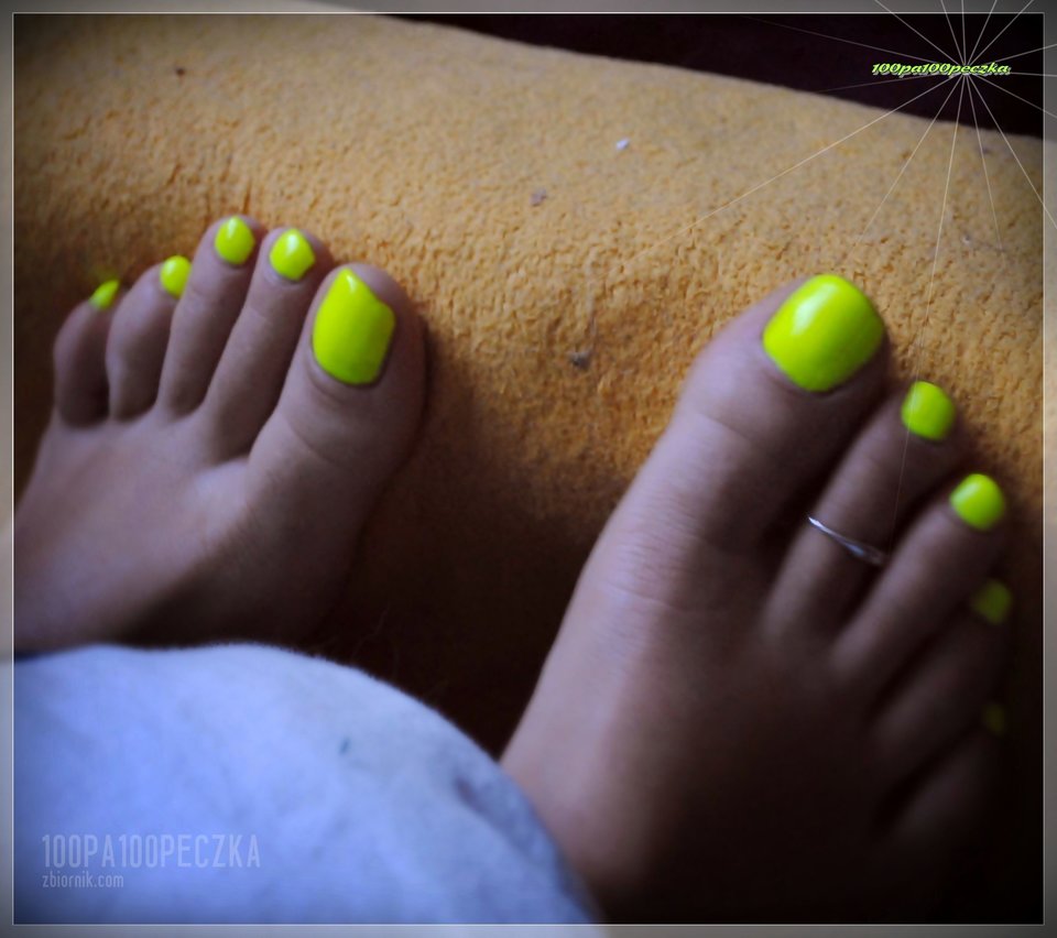 Neon Yellow #34 - 100pa100peczka