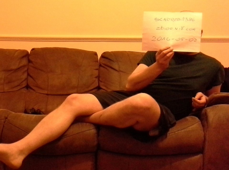 20160502_032718-1.jpg - scarred1986